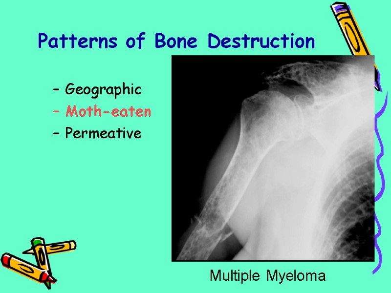 Patterns of Bone Destruction Geographic Moth-eaten Permeative Multiple Myeloma